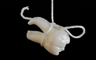 Everything You Need to Know About Dental Extractions: What to Expect and How to Prepare